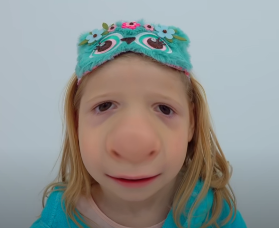 nastya s nose is huge